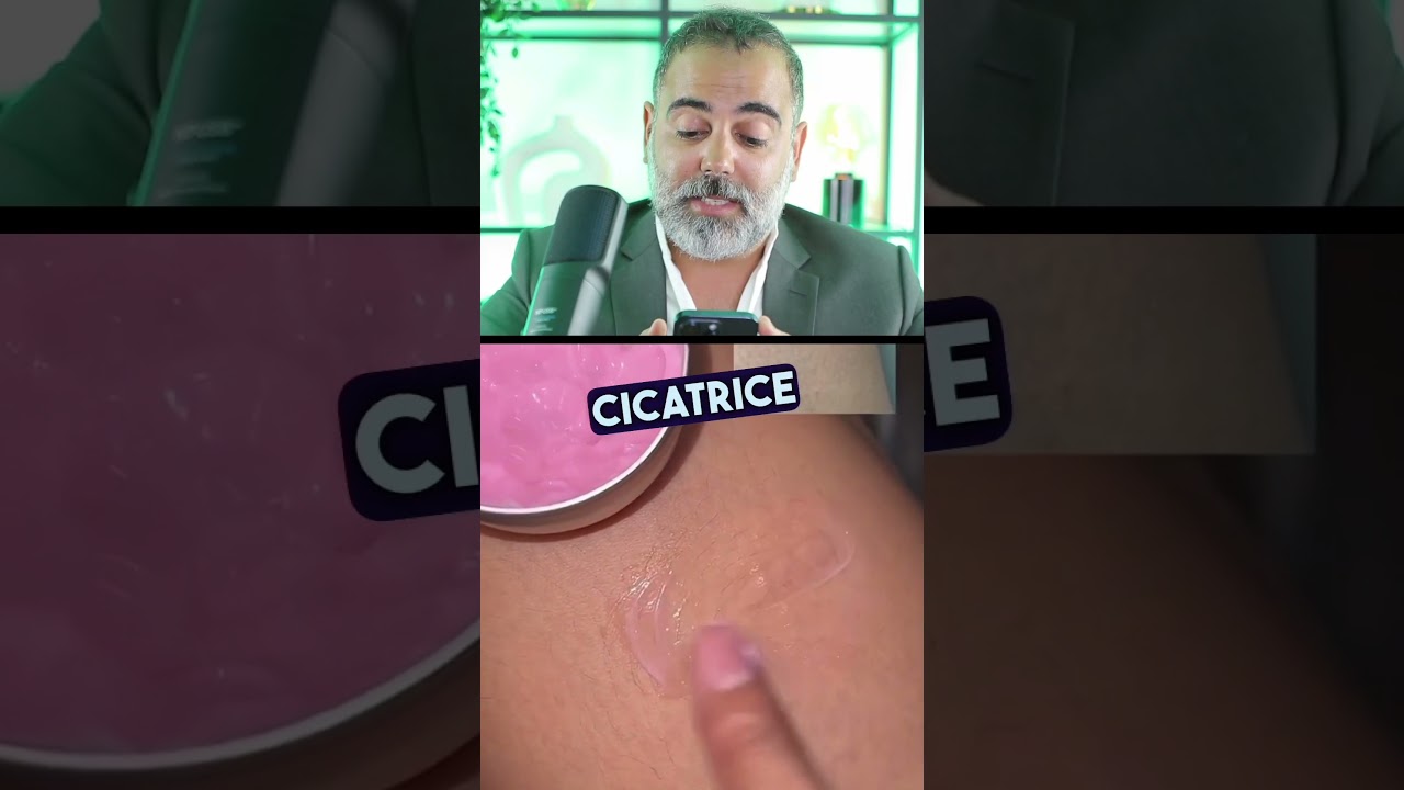 Vous avez des cicatrices chéloïdes ? Découvrez comment les améliorer ! ✨