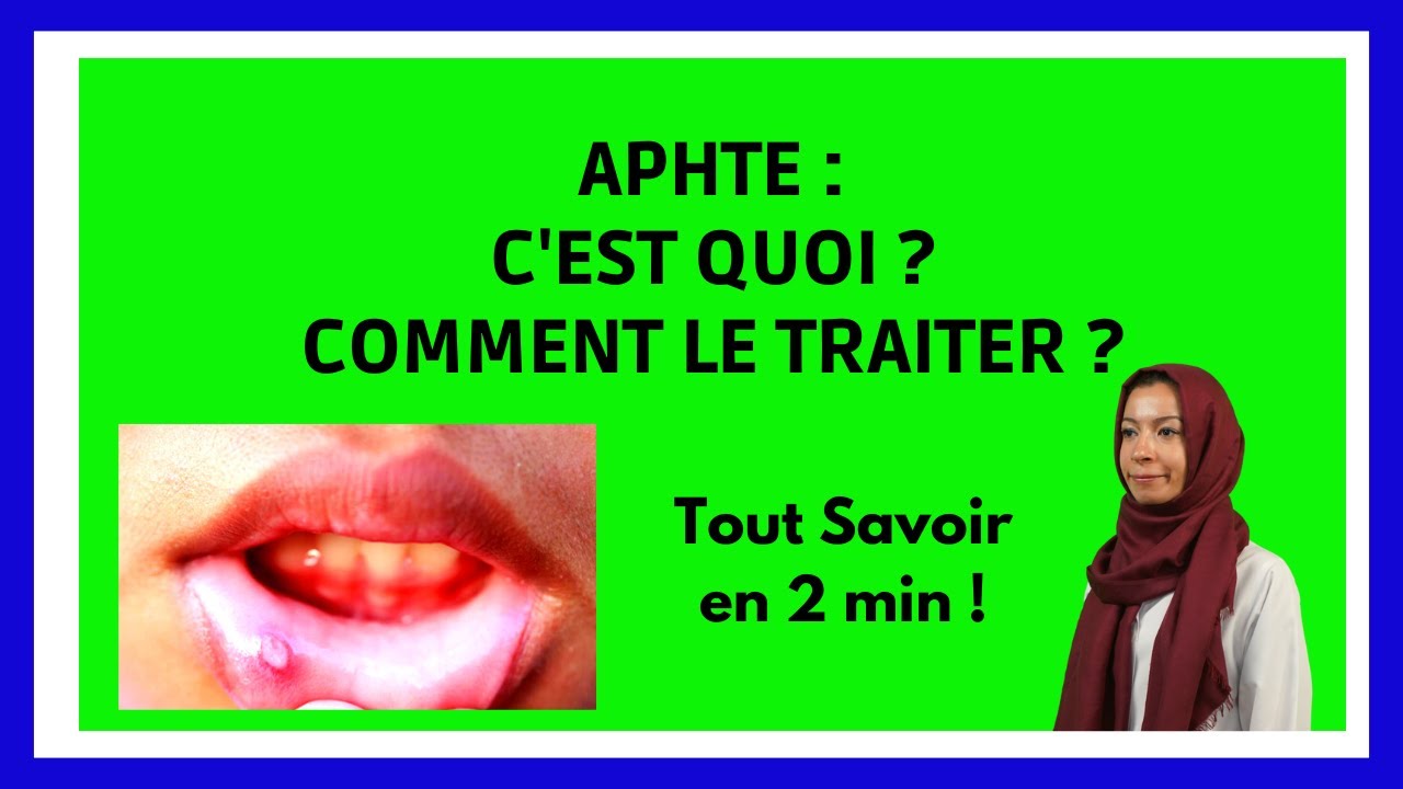 APHTE : Causes, Prévention Traitements en 2 min !