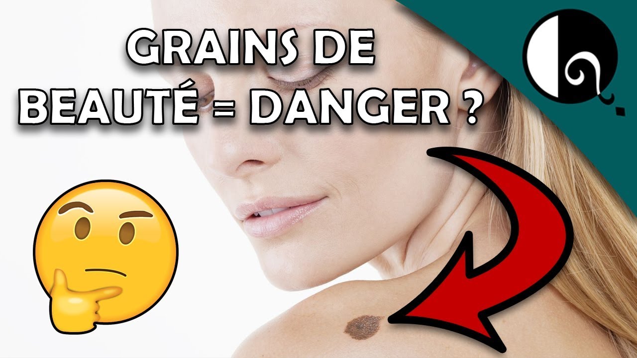 LES GRAINS DE BEAUTÉ = DANGER ?
