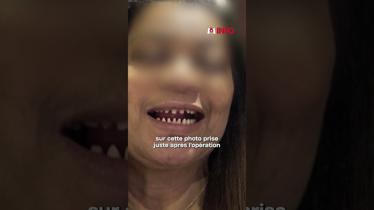 Enquête sur le dangereux business du blanchiment dentaire à bas coût en Turquie