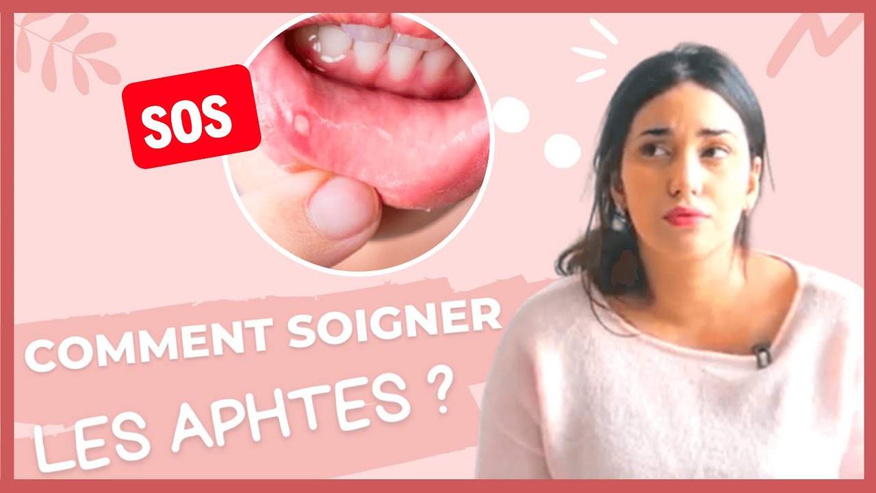 Solutions aphtes avec les plantes : bouche, lèvres, langue, gencive, NATUREL RAPIDE & EFFICACE