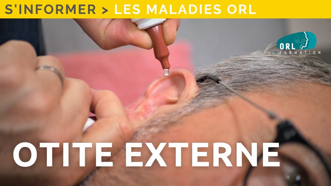 Comment guérir une otite externe? | Maladie, symptômes, traitement