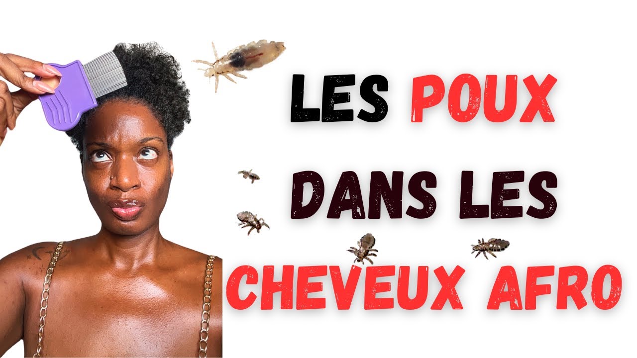 Traitement anti-poux : ce que personne ne dit pour les cheveux afro