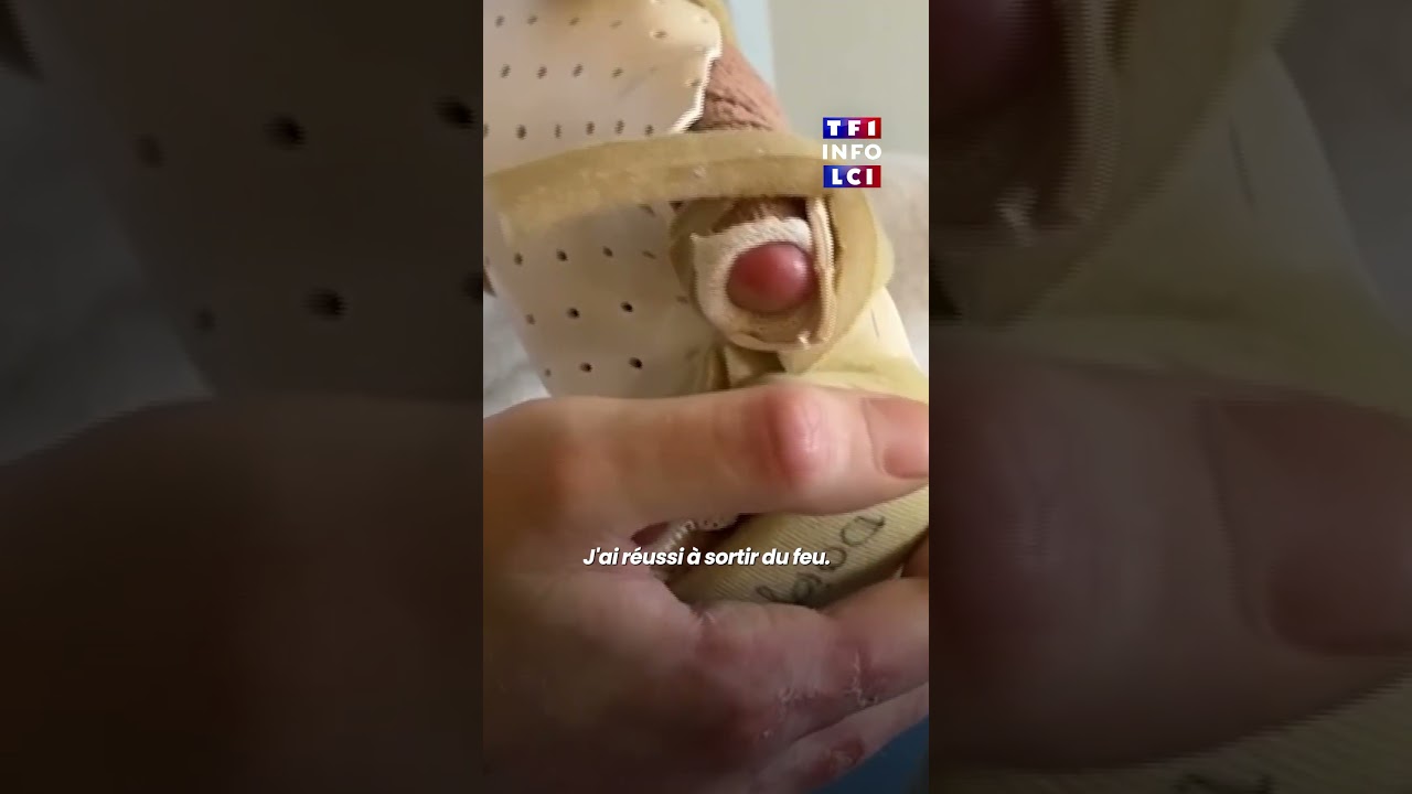 Un rescapé de l'incendie de Crans-Montana raconte la nuit de l'horreur｜TF1 INFO