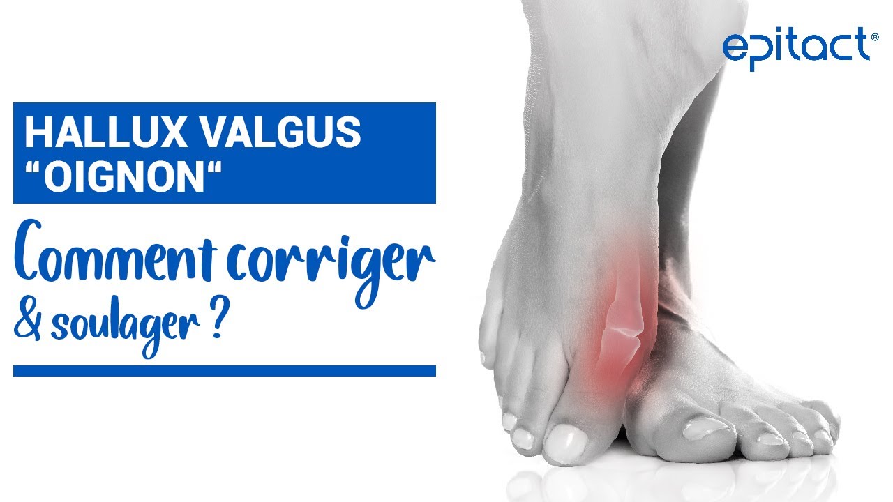 TUTO | Hallux Valgus : Comment Corriger & Soulager ? | EPITACT Médical