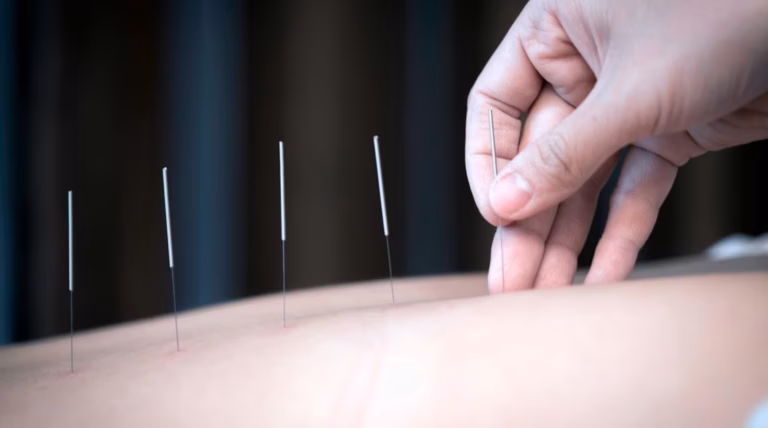 Acupuncture : applications et preuves scientifiques