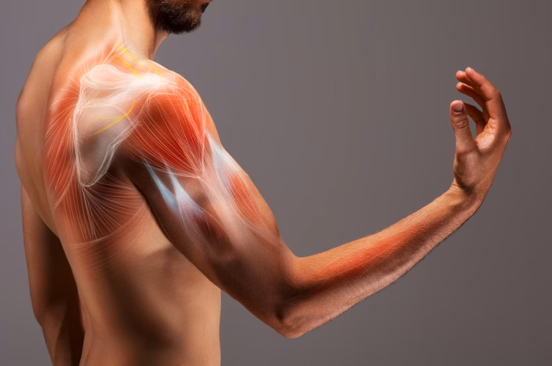 Déchirure musculaire : remèdes naturels et récupération