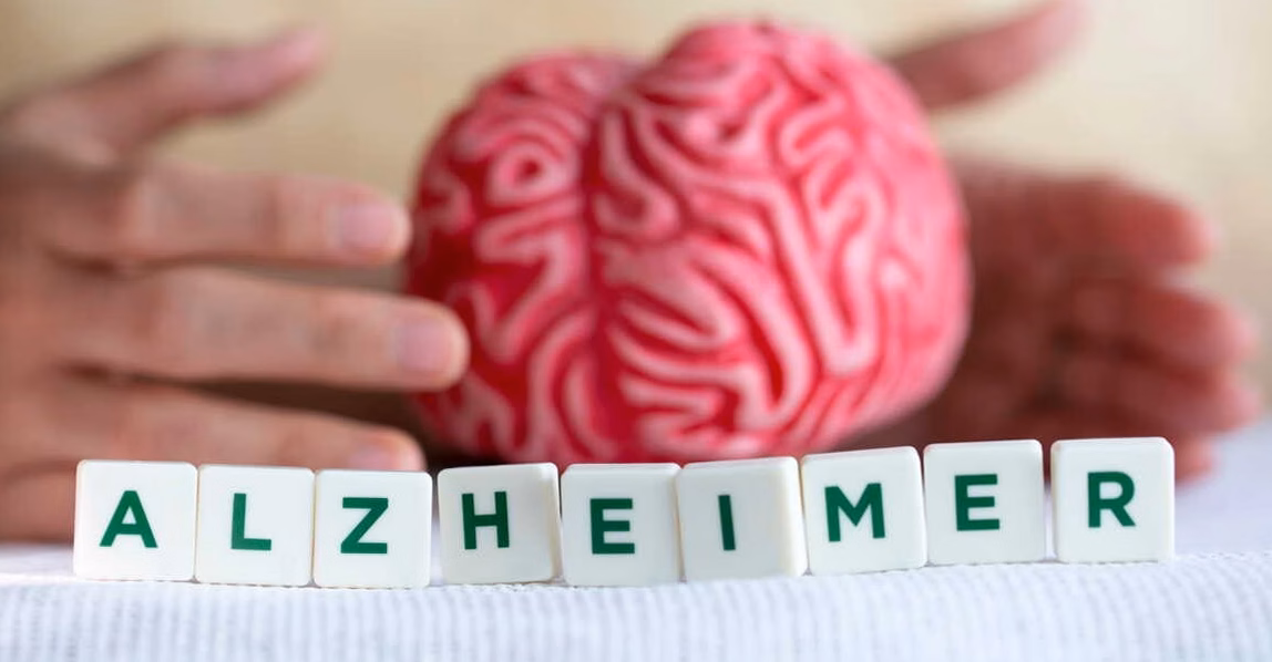 La FDA autorise un nouveau test innovant de Roche et Eli Lilly pour dépister la maladie d&rsquo;Alzheimer