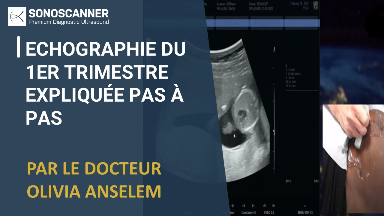 Webinar Sonoscanner: Echographie du 1er trimestre expliquée pas à pas